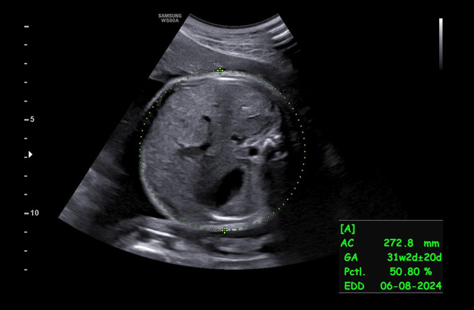 Baby Scans Growth